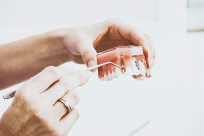 Dental implants